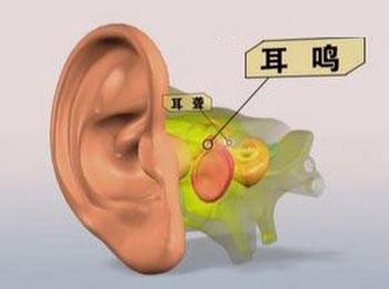 我的耳朵里是不是‘烂’了，怎么反复流脓水？